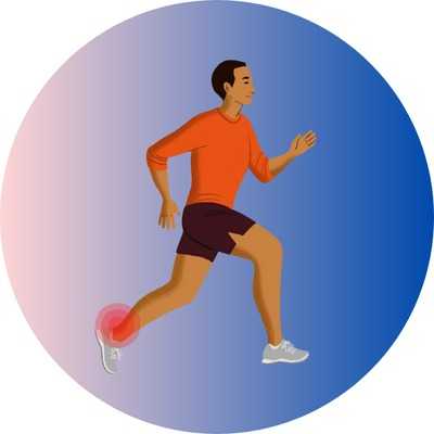 Is it okey to run with achilles tendonitis